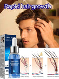 Hair Growth & Anti-Hair Loss Serum Scalp Nutrition