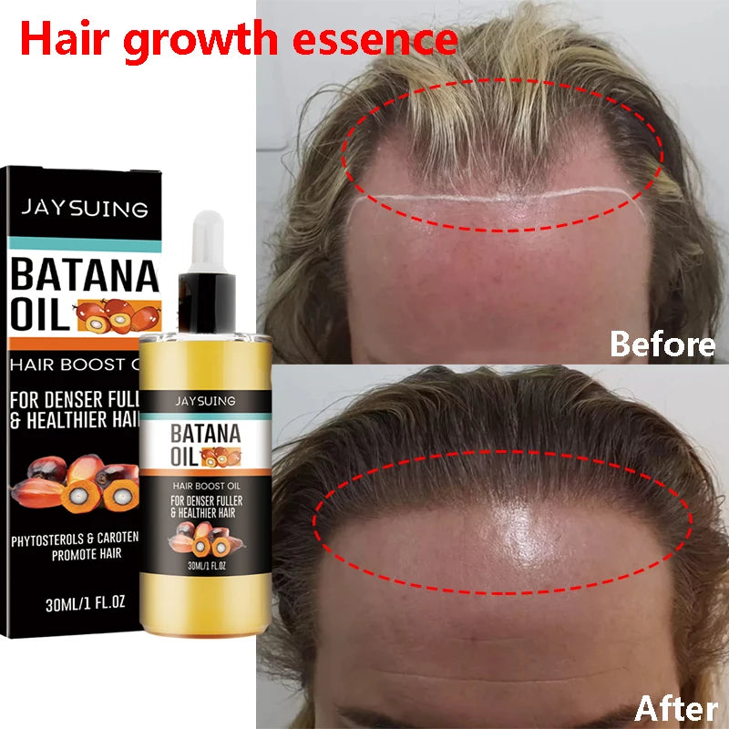 Hair Growth Set, Batana Oil & Hair Mask
