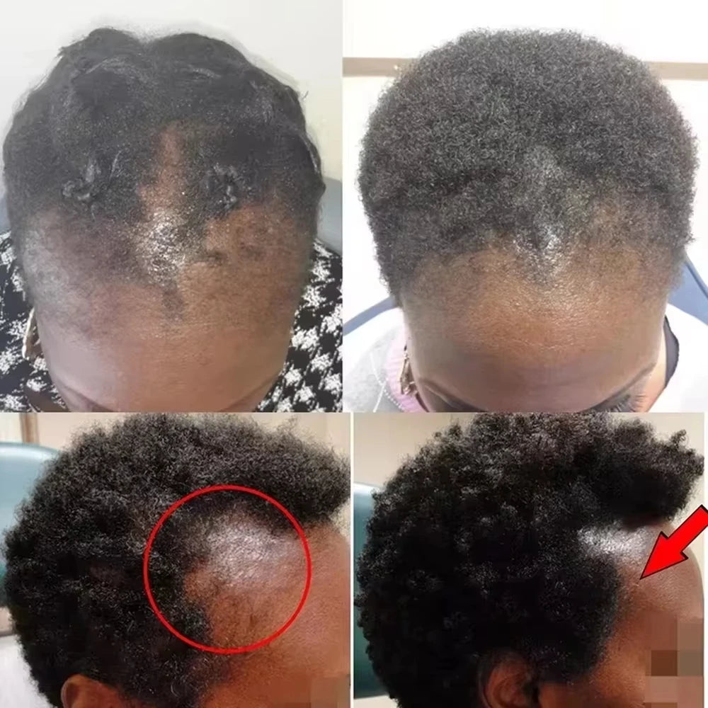 Hair Growth Set, Batana Oil & Hair Mask