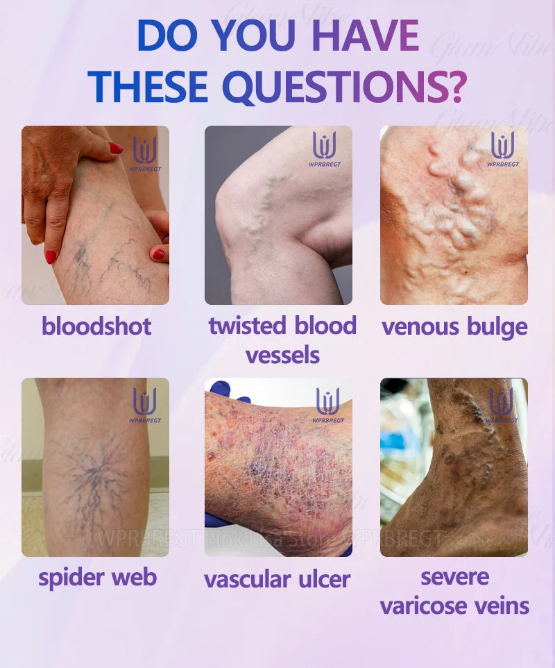 Restore normal tendons and veins, no pain