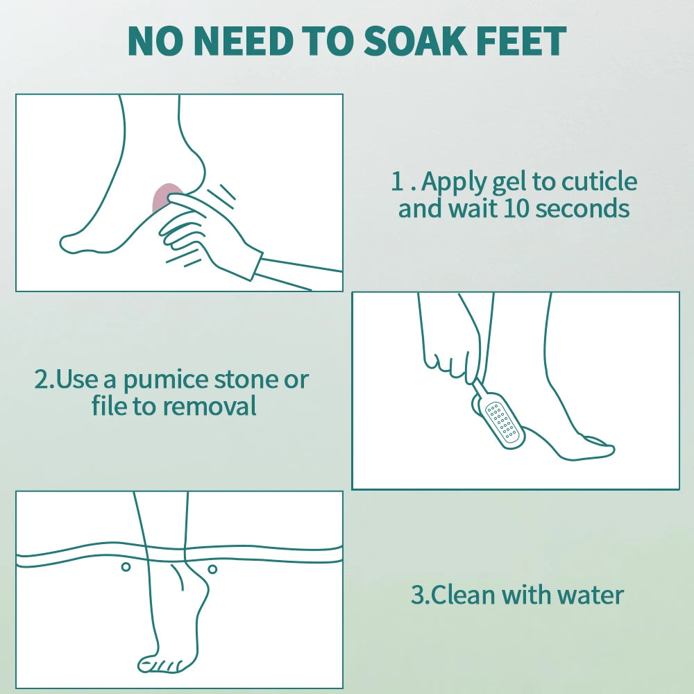Nailpop Foot File Set – Dead Skin & Callus Remover, 60ml