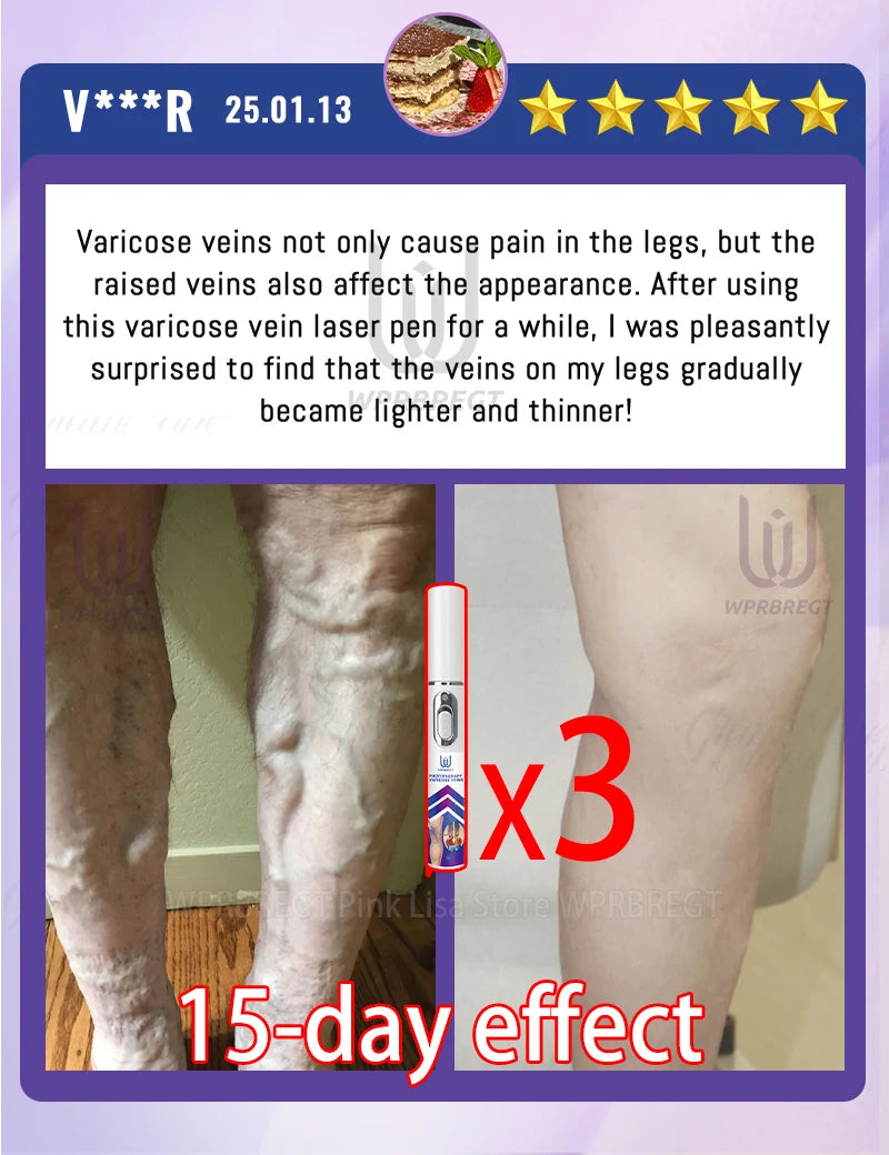 Restore normal tendons and veins, no pain