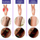 Restore normal tendons and veins, no pain