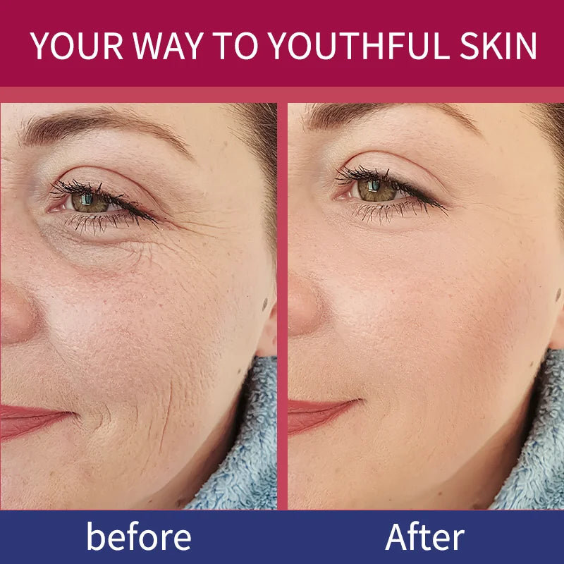 Bio Collagen Face Mask with Hyaluronic Acid – Anti-Aging & Deep Hydration