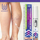 Restore normal tendons and veins, no pain