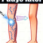 Restore normal tendons and veins, no pain