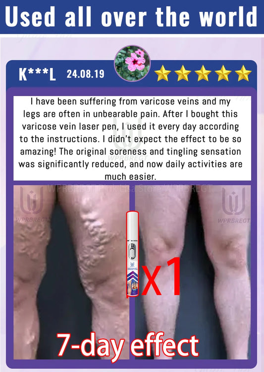 Restore normal tendons and veins, no pain