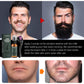 Beard & Moustache Thickening Spray – Hydrating Formula for Faster, Stronger Facial Hair Growth